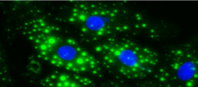 Nutrition, Metabolism and Cellular Stress