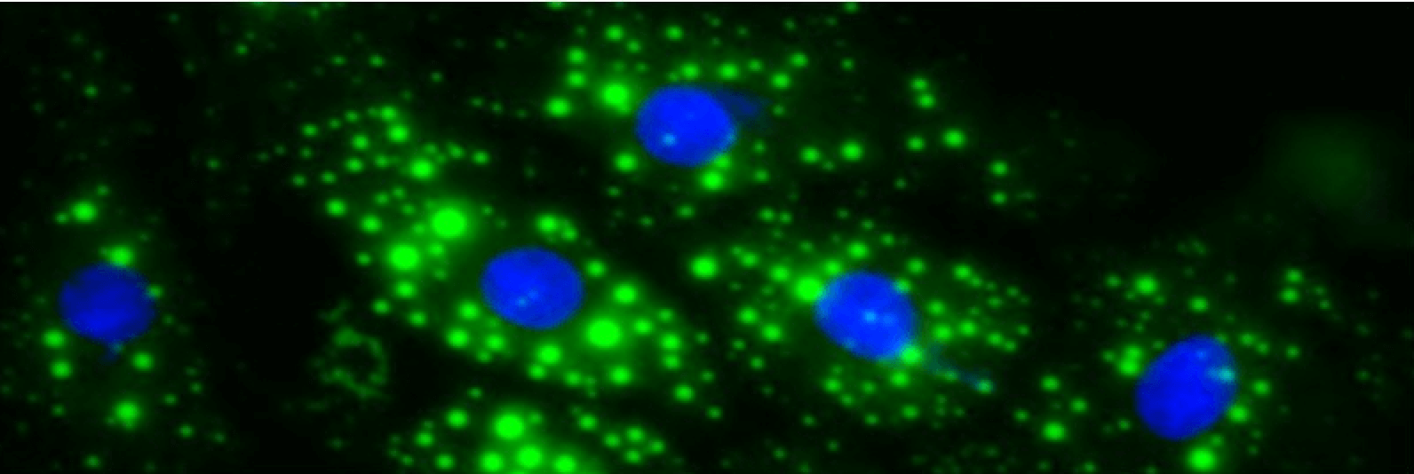 Nutrition, Metabolism and Cellular Stress