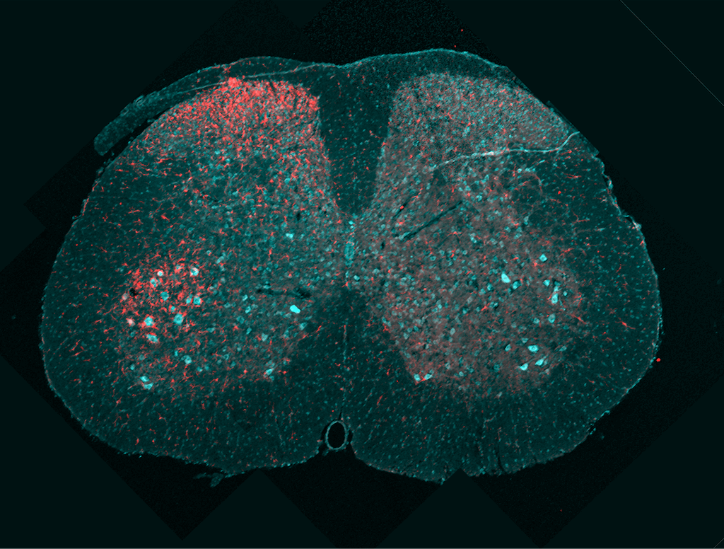 Neurosciences